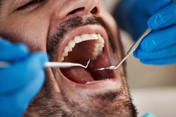 Best Cracked Tooth Emergency Dentist  in Marshall, WI