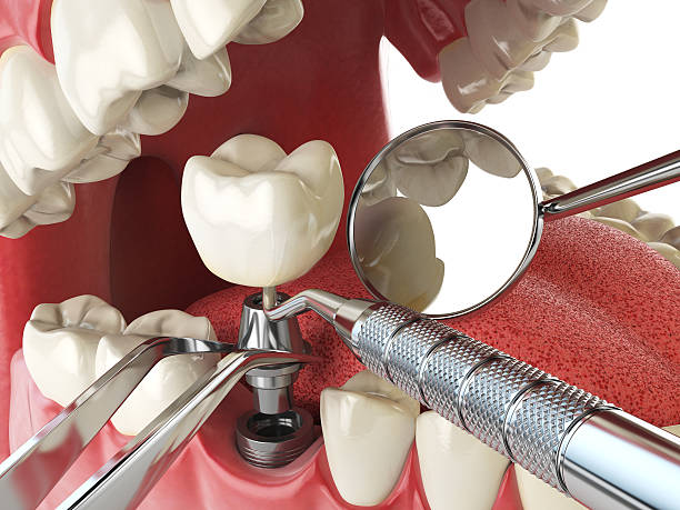 Best Cracked Tooth Emergency Dentist  in Marshall, WI