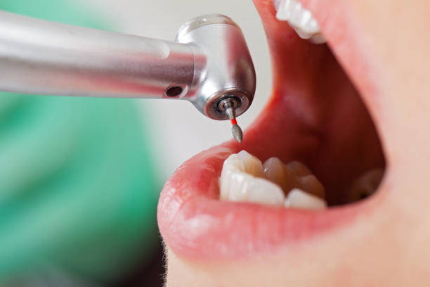 Best Knocked-Out Tooth Emergency  in Marshall, WI